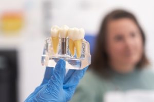 tooth implants cost india bella vista