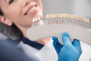 porcelain veneers cost colour