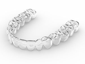 What Is Better Invisalign or Braces aligners