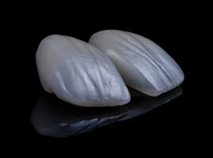 Do Porcelain Veneers Stain colour