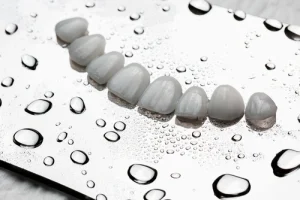 types of dental veneers shells
